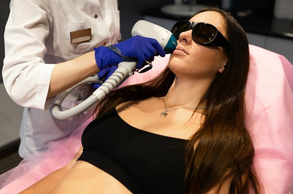 Épilation laser visage : une solution permanente pour une peau lisse